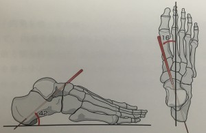 距骨下関節　運動軸